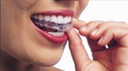Quality Custom Fit Invisalign Braces in St Louis! 
